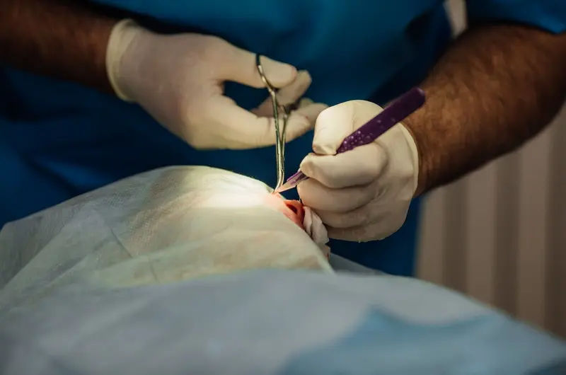 العلاج الجراحي لسرطان الجلد في إسرائيل