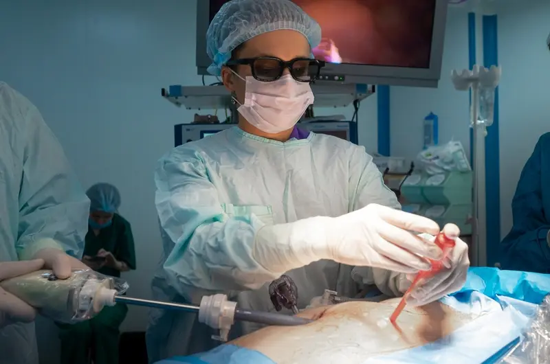 Laparoscopic hysterectomy in Israel