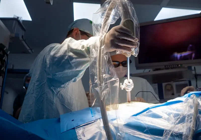 Laparoscopic Cholecystectomy in Israel