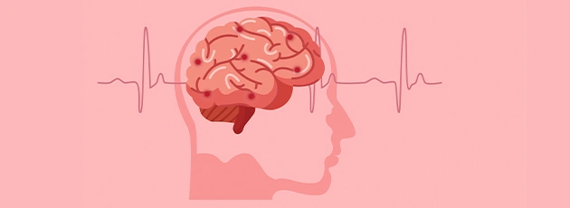 Brain Cancer Treatment in Israel