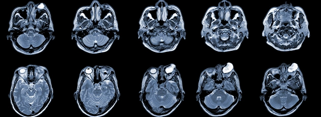 Neurosurgery in Israel