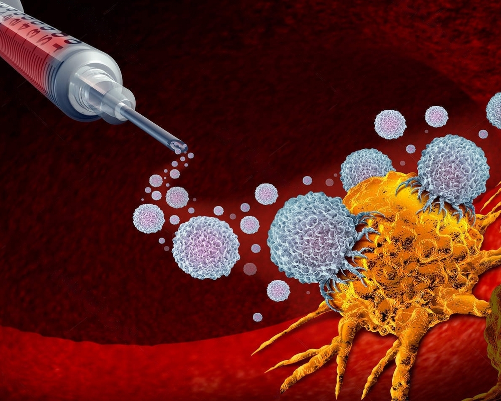 ONCOSIL – a new method for treating inoperable pancreatic cancer in Israel