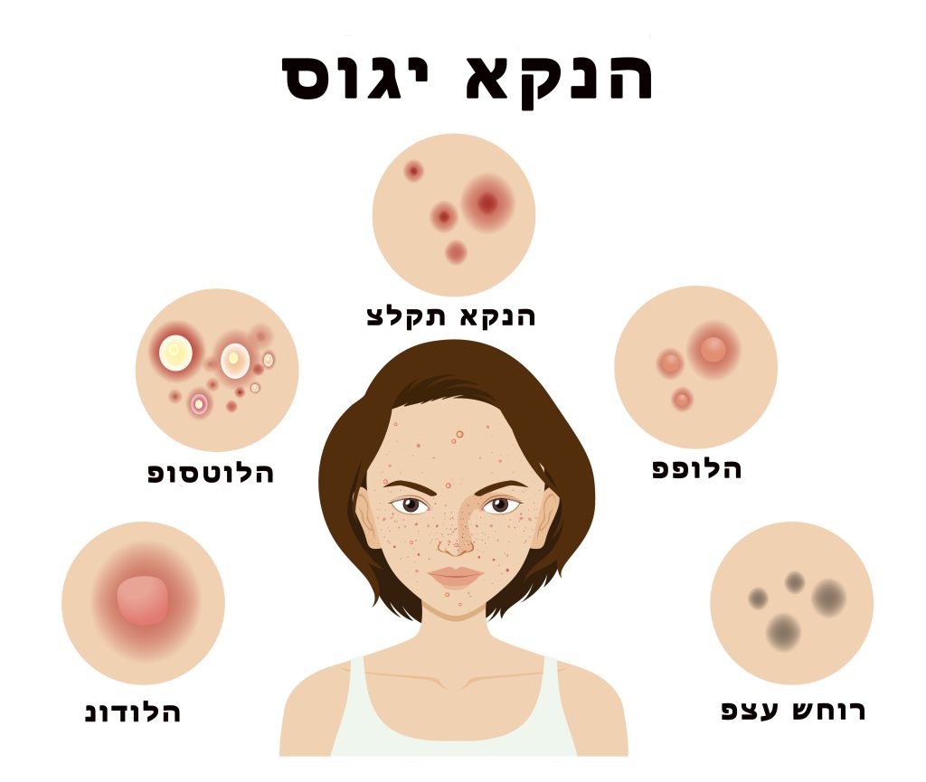 סוגי אקנה בעור ואיור פצעונים