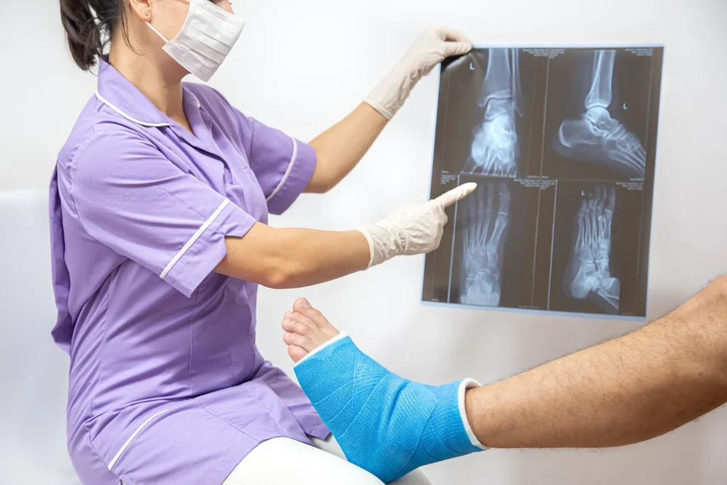 אבחון נוירומה של מורטון באמצעות MRI