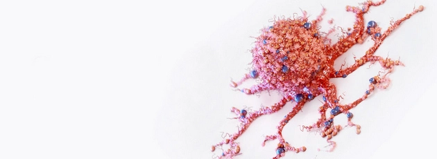 Лечение рака 3 стадии в Израиле