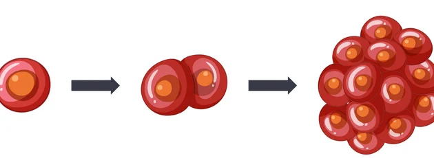 Лечение рака 4 стадии в Израиле