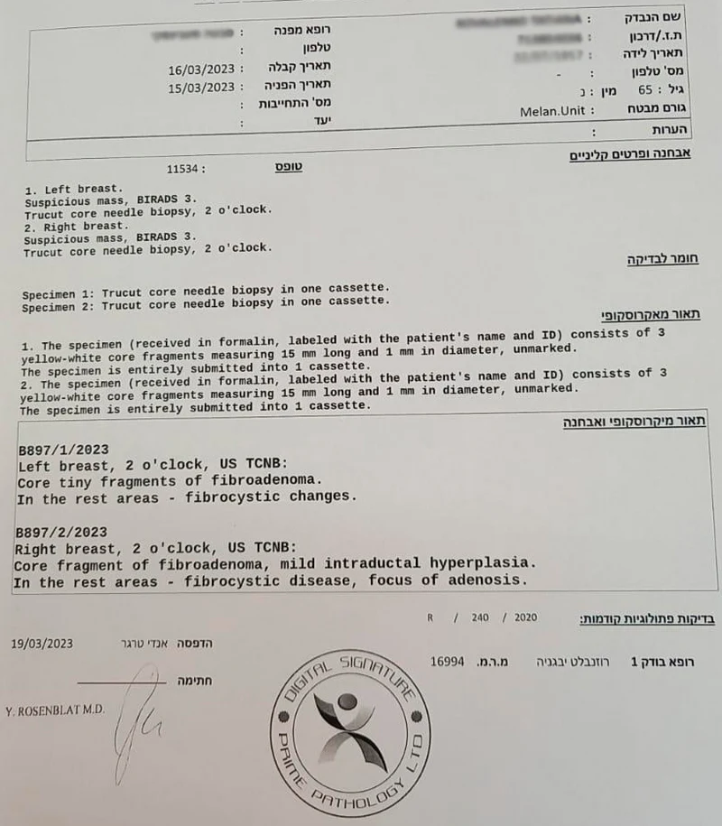 Биопсия молочной железы в Израиле