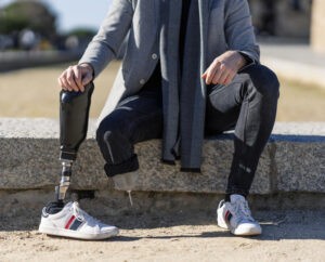 В клинике Ихилов проведена целая серия операций по остеоинтеграции