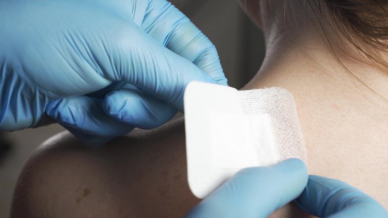 Местная терапия при лечении рака кожи в Израиле