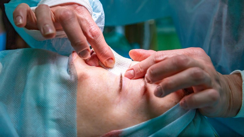 Операция Моса при раке кожи в Израиле