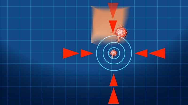 Таргетная терапия при лечении рака костей в Израиле